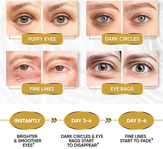 Zollur Under Eye Patches 24k Gold Mask, patch-uri pentru ochi cu Amino și colagen pentru ochi pufosi și cearcăne tratament